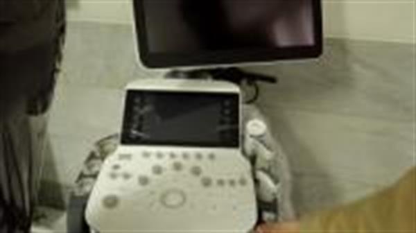 بیمارستان امام خمینی (ره ) مجهز به یکی از پیشرفته ترین دستگاههای سونوگرافی در غرب کشور شد